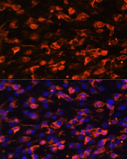 PIK3C2A Antibody