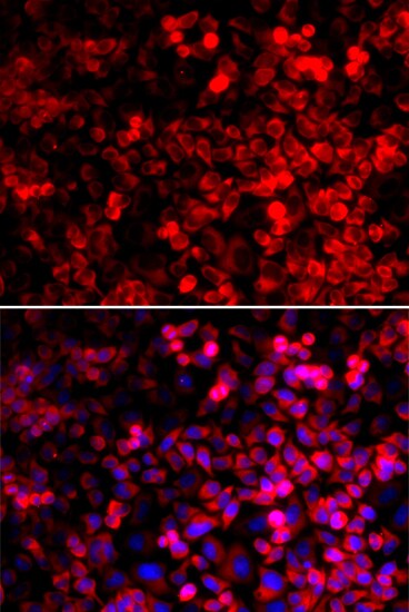 QARS Antibody