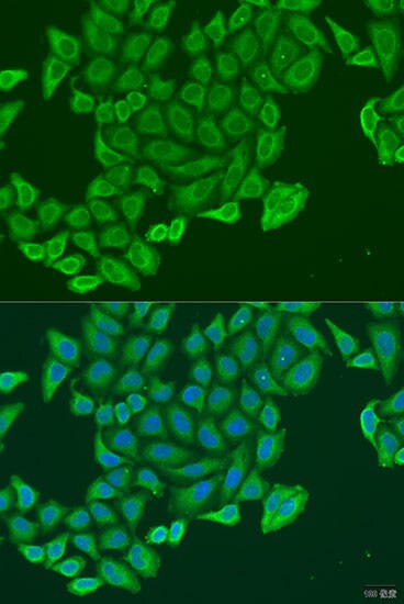 EXOC2 Antibody