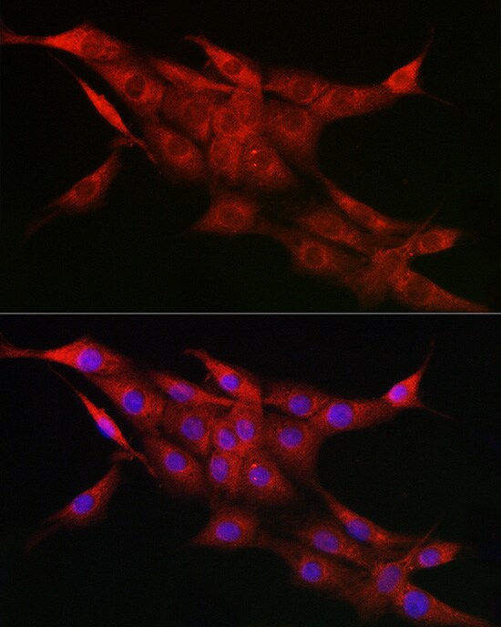Cytochrome P450 1A1 Antibody