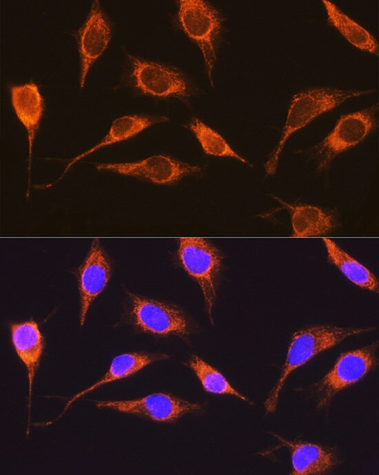RCN1 Antibody