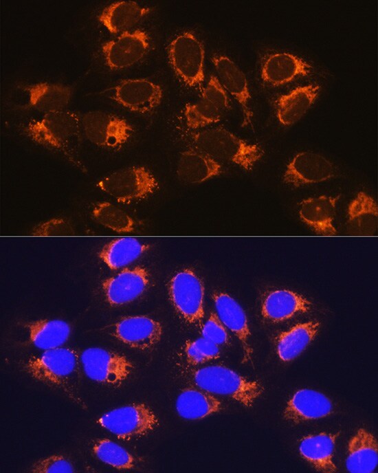 RCN1 Antibody