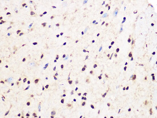 PCIF1 Antibody