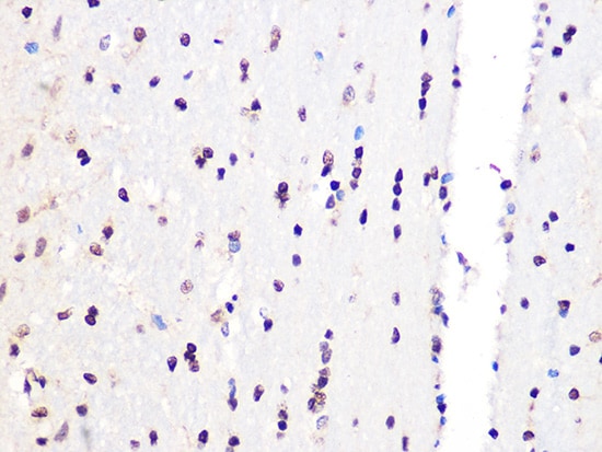 PCIF1 Antibody