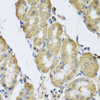 CaM Kinase II gamma Antibody