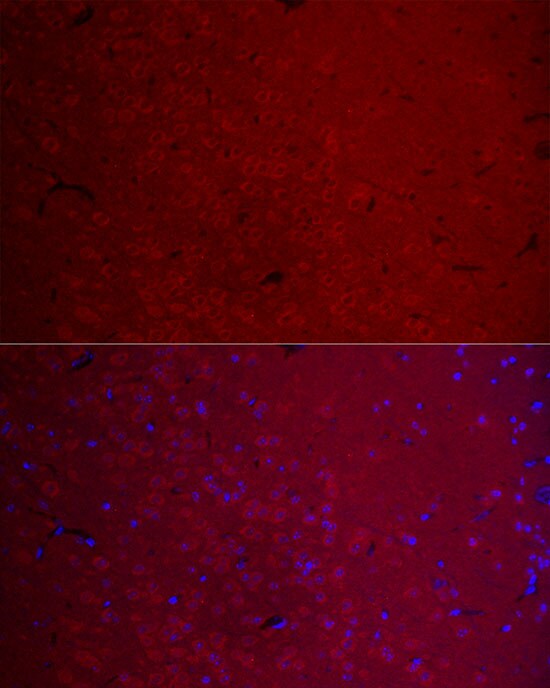CaM Kinase II gamma Antibody