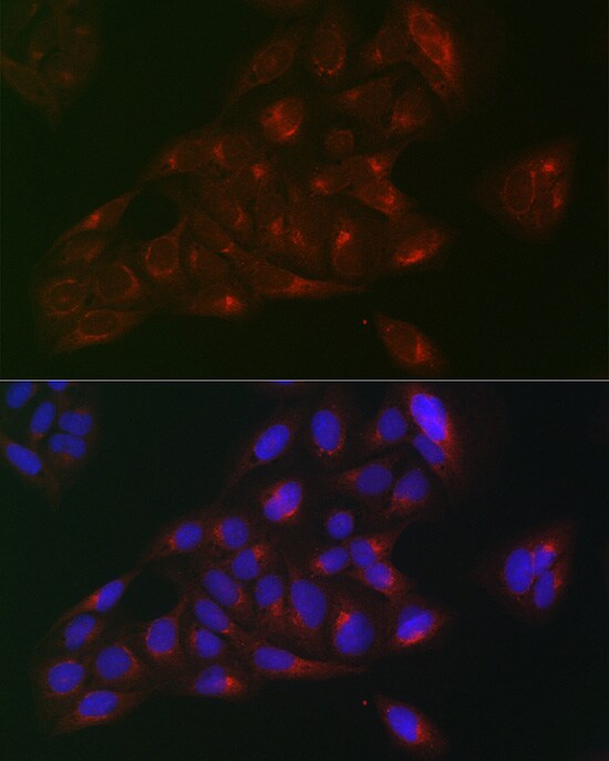 RAB1B Antibody