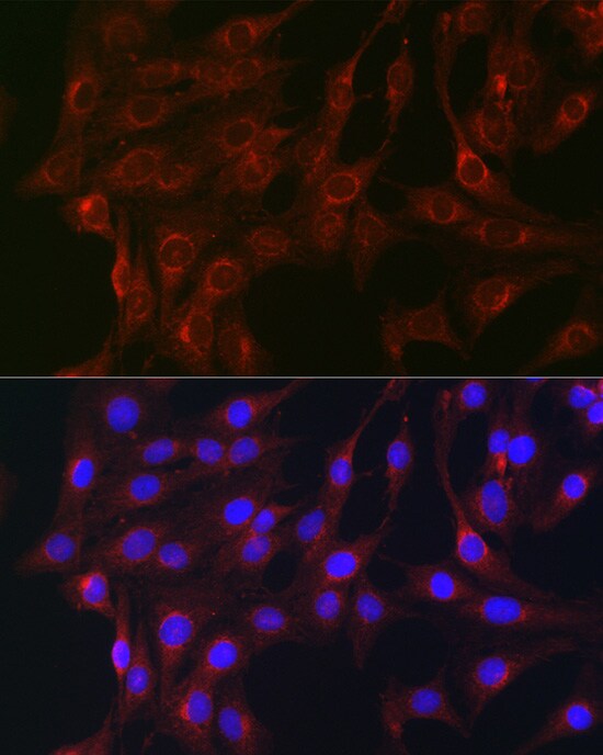 RAB1B Antibody