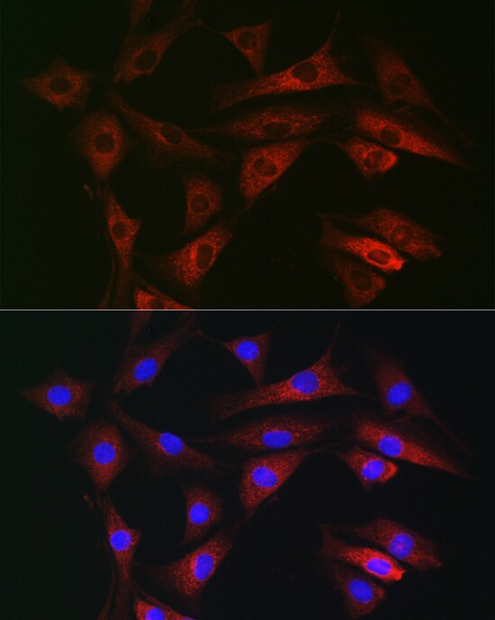 RAB1B Antibody