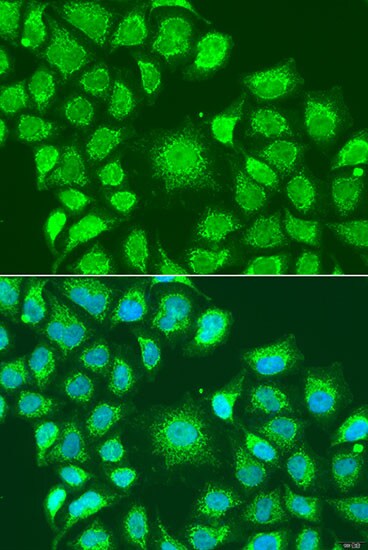 ATG4D Antibody