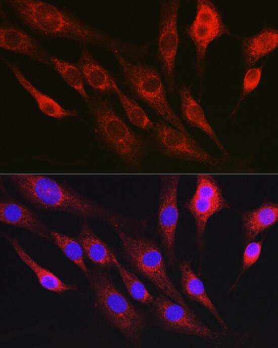 RhoC Antibody