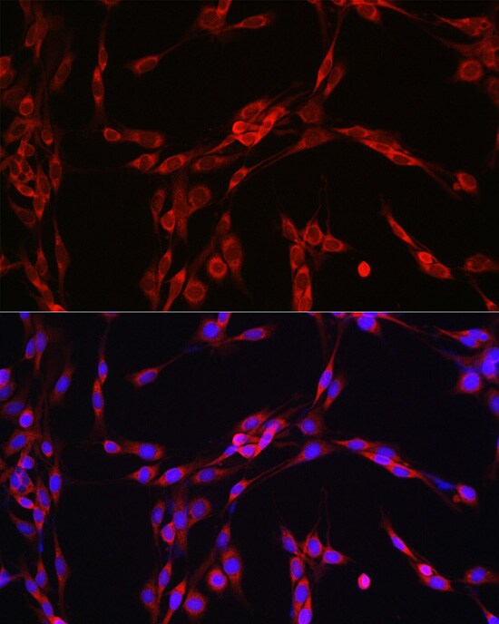 SEC61B Antibody
