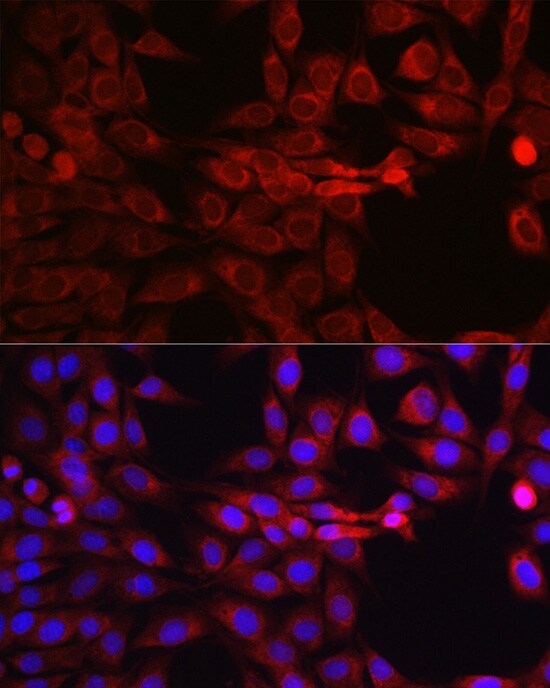 SEC61B Antibody