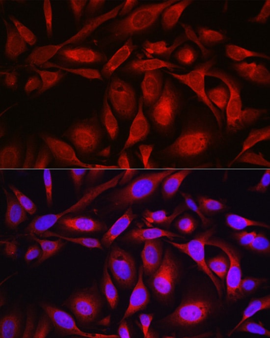 SEC61B Antibody