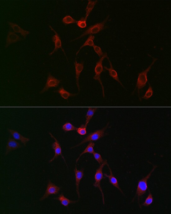 transgelin 2 Antibody