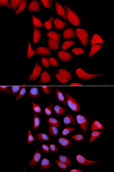 Proteasome 20S alpha 6 Antibody