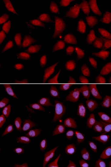 DLG7/HURP Antibody