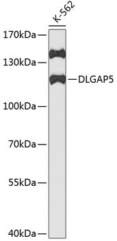 DLG7/HURP Antibody