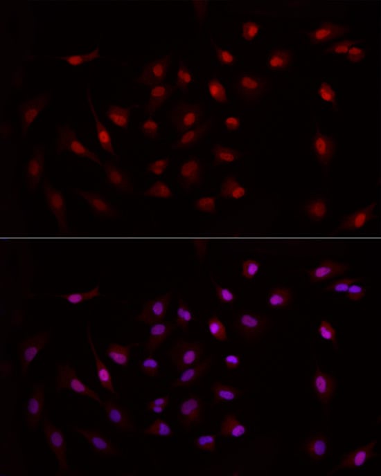 KAT2A/GCN5 Antibody