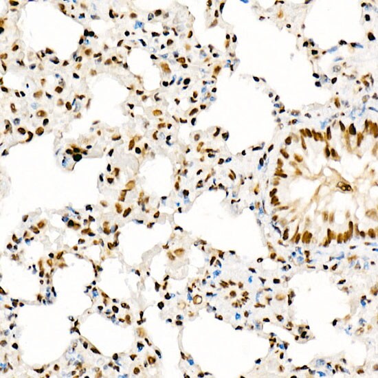 KAT2A/GCN5 Antibody