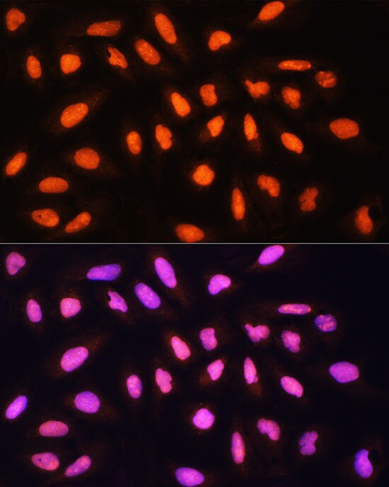 KAT2A/GCN5 Antibody