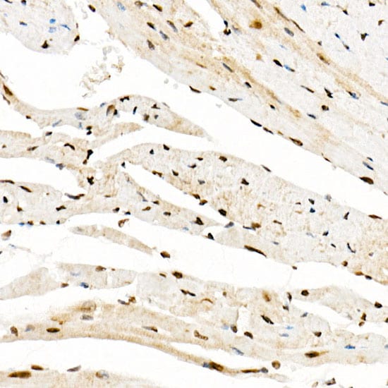 KAT2A/GCN5 Antibody