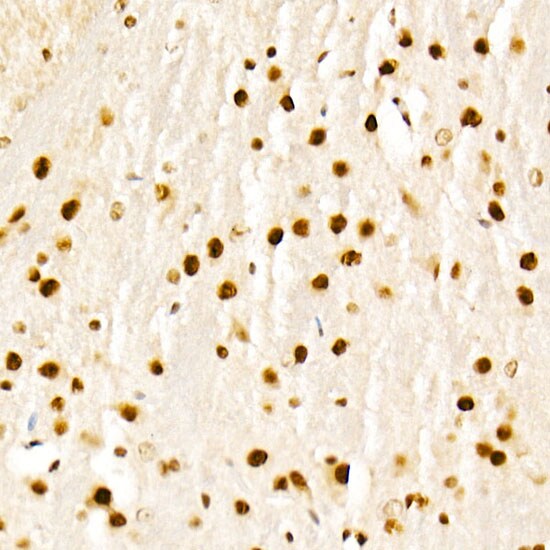KAT2A/GCN5 Antibody