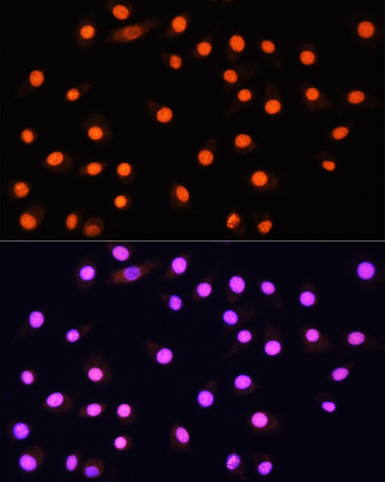 KAT2A/GCN5 Antibody