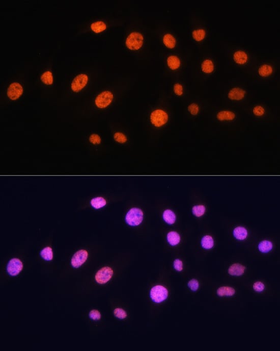 KAT2A/GCN5 Antibody