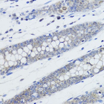 H4 Clustered Histone 1 [Monomethyl Lys20] Antibody