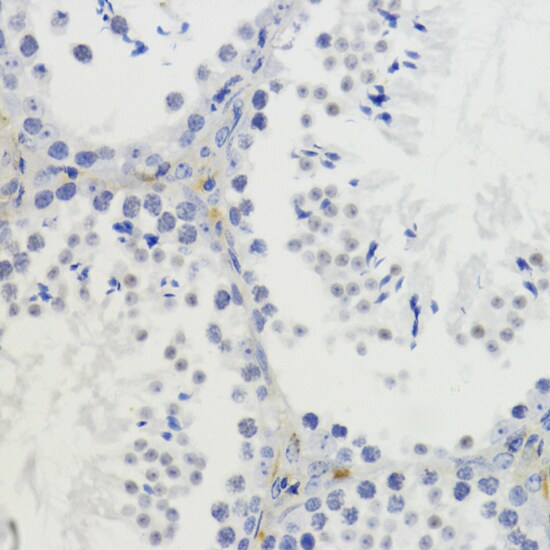 H4 Clustered Histone 1 [Dimethyl Lys20] Antibody