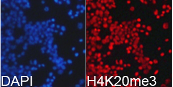 H4 Clustered Histone 1 [Trimethyl Lys20] Antibody