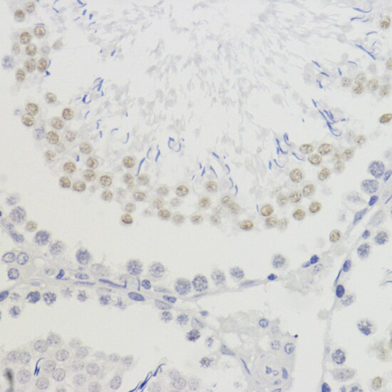 H4 Clustered Histone 1 [Trimethyl Lys20] Antibody