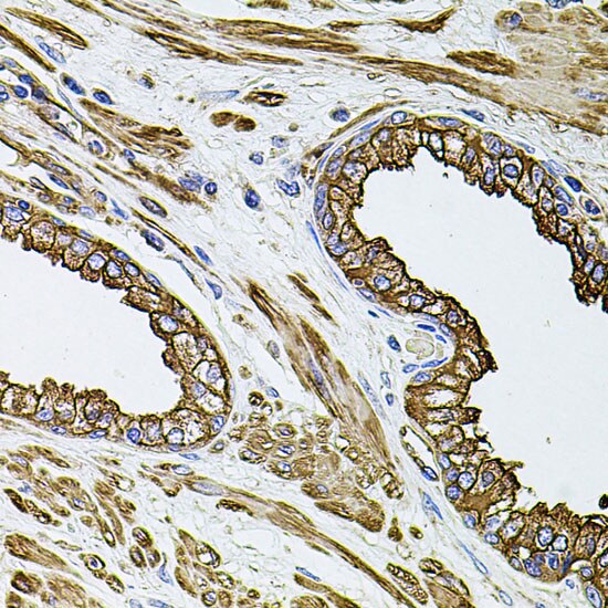Filamin B Antibody