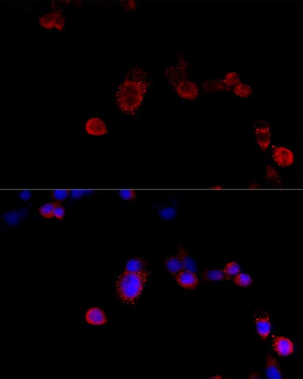 Filamin B Antibody