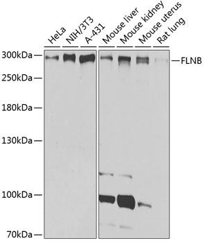 Filamin B Antibody