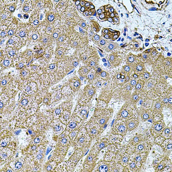 Filamin B Antibody
