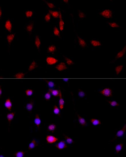 Filamin B Antibody