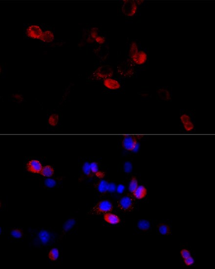 Filamin B Antibody