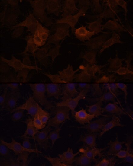 Filamin B Antibody