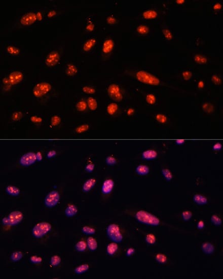 ILF3 Antibody