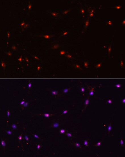 ILF3 Antibody