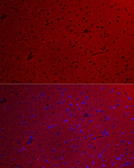 GO Protein alpha Antibody