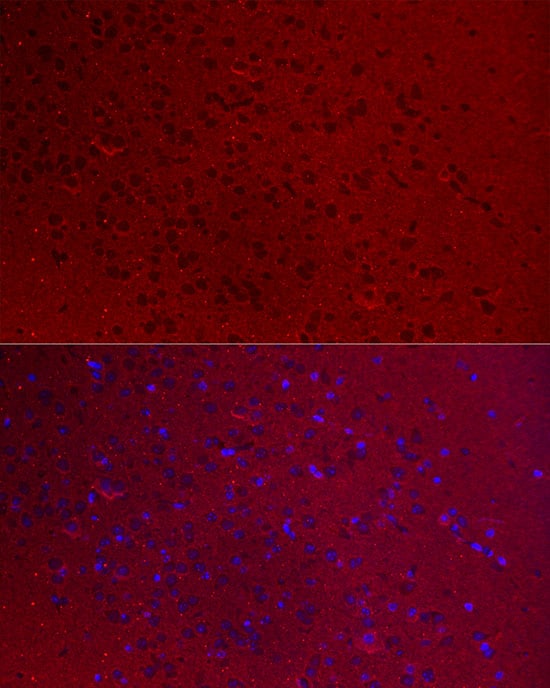GO Protein alpha Antibody