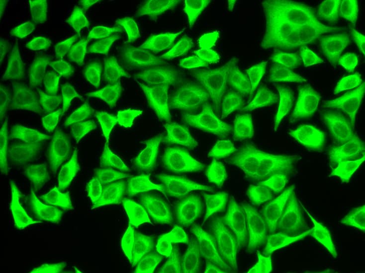 ALDH4A1 Antibody