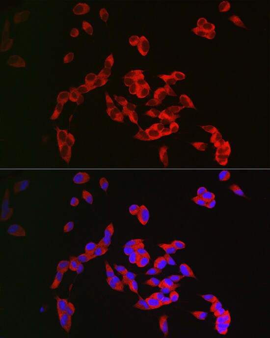 CRMP1 Antibody