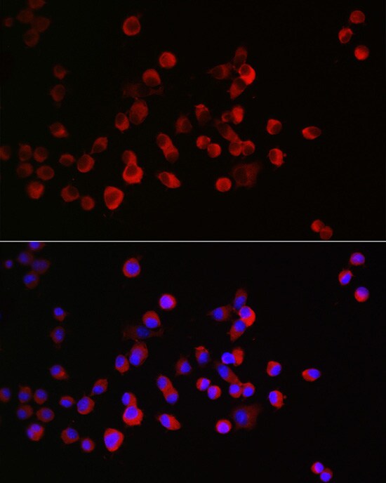 CRMP1 Antibody