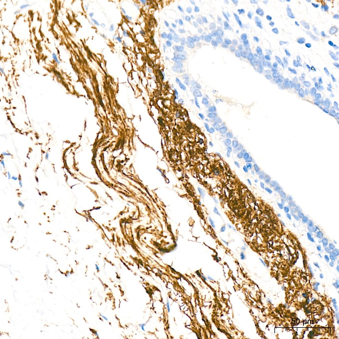 Elastin Antibody