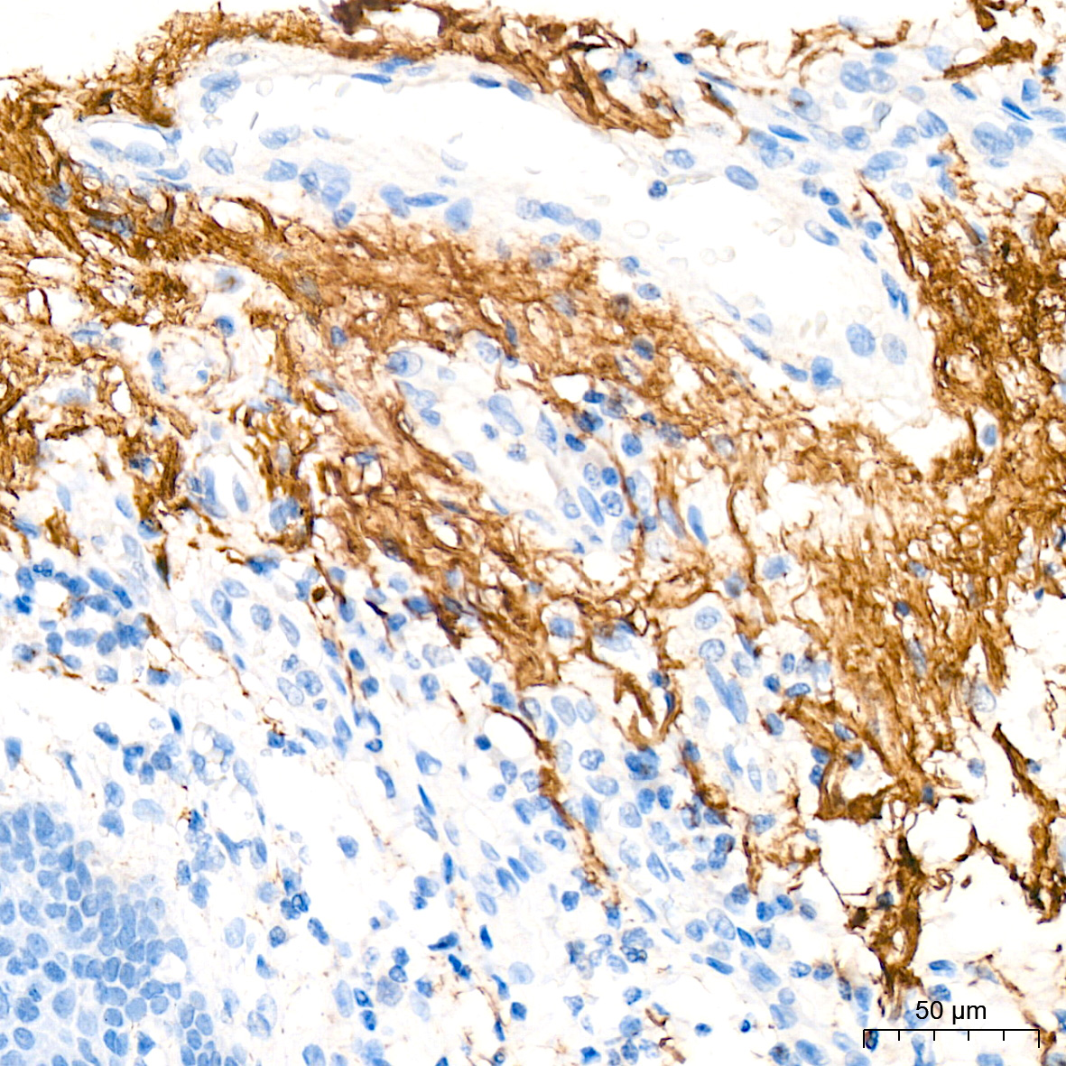 Elastin Antibody