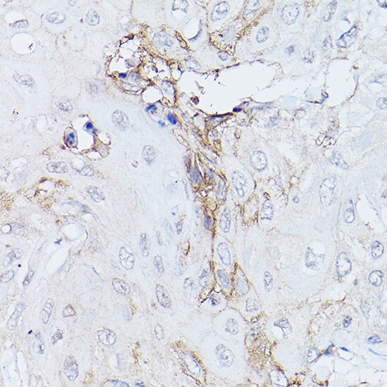 GNA11 Antibody